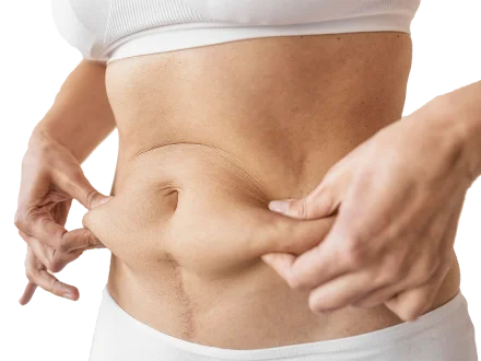 liposuccion