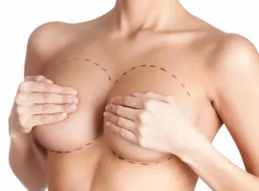 augmentation mammaire